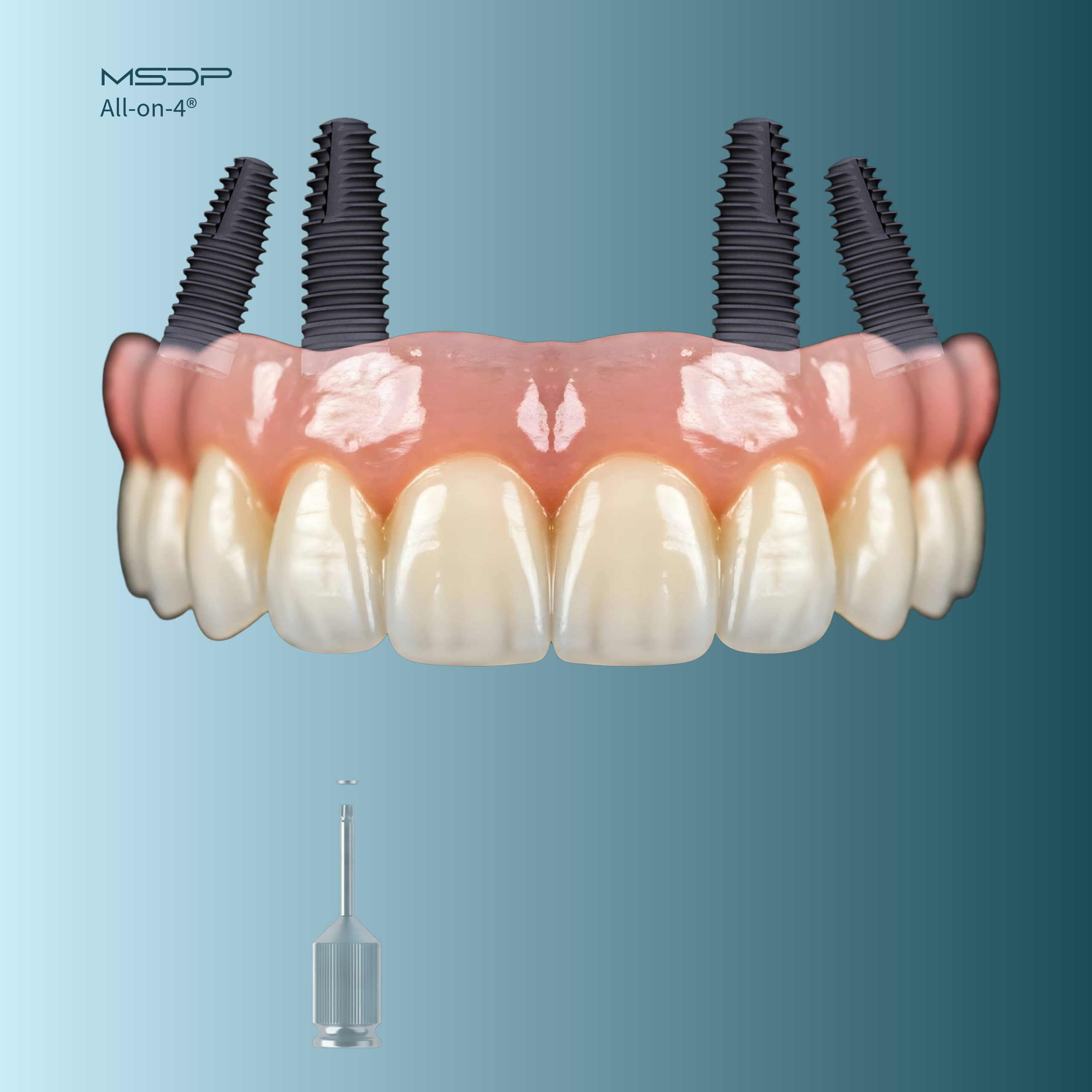 ALL-on-4® DENTAL IMPLANTS